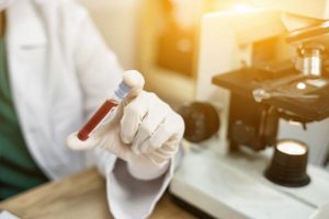 Lab technician holding tube of blood next to microscope testing for insulin resistance